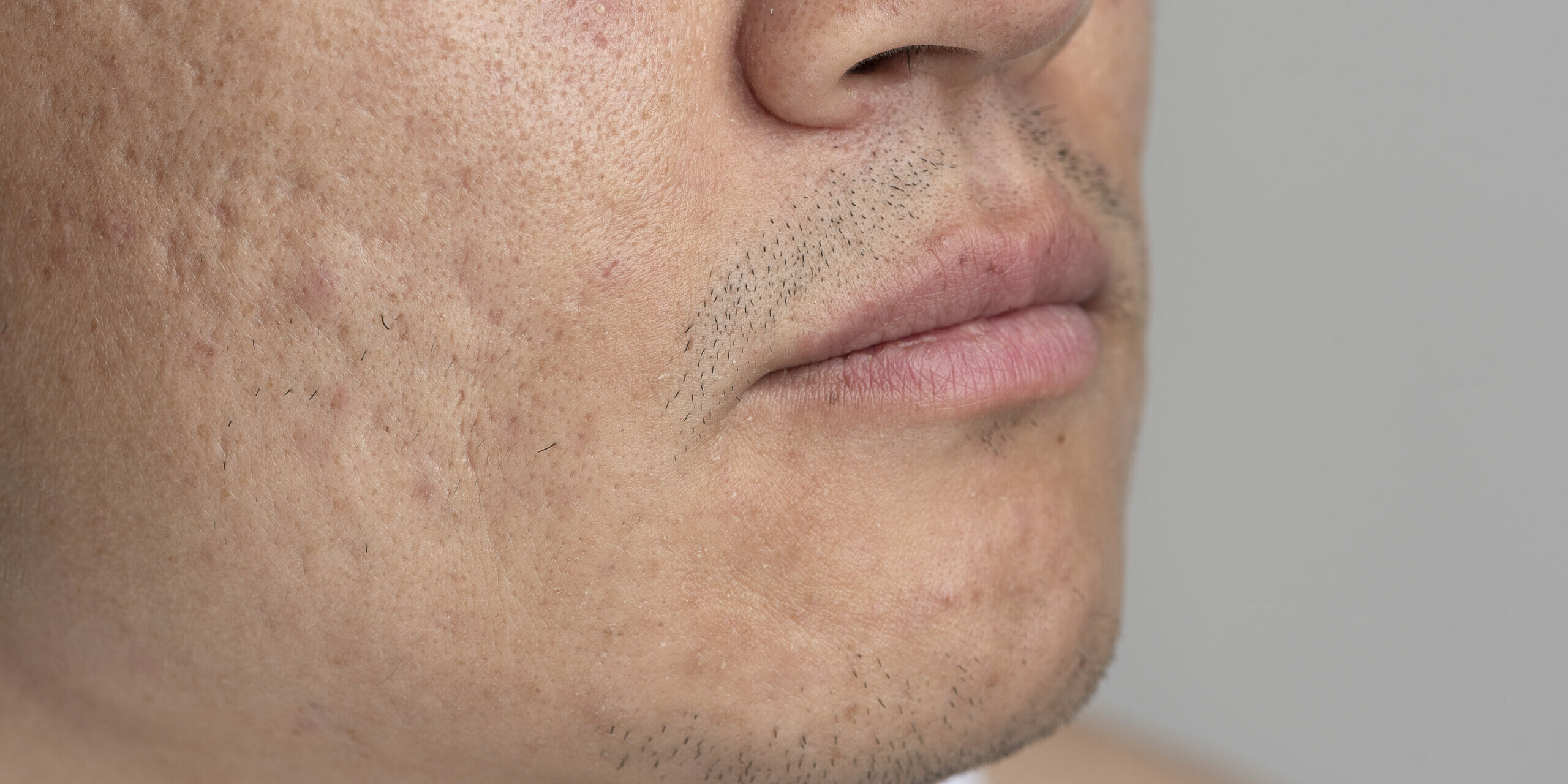 close-up-skin-pores-face-care-routine Close Up Skin Pores Face Care Routine